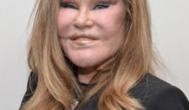 An Unusual Cat Woman: See how she looked before and after plastic surgery…