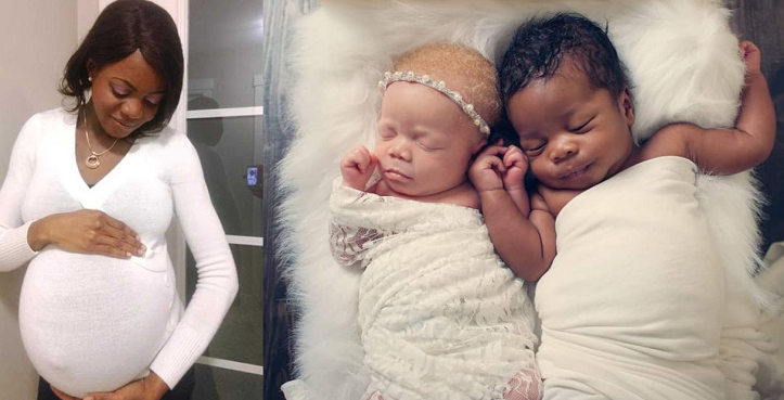 Photographer gives birth to twins, one black and one albino – I think they’re beautiful