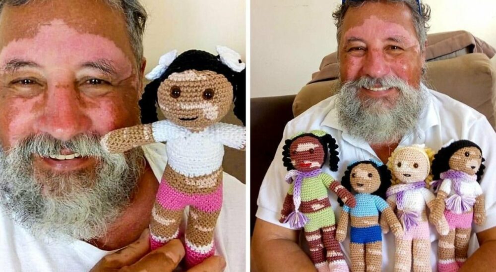 This man knits dolls for special children to help them feel better, but the are not an ordinary ones…