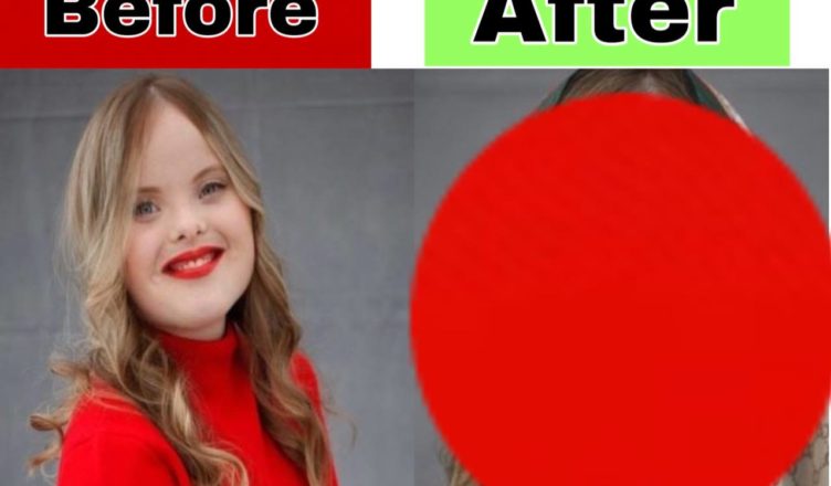 This Wonderful Girl Has Down Syndrome, But Her Illness Didn’t Stop Her From Becoming Who Wanted To Be… See her before and now…